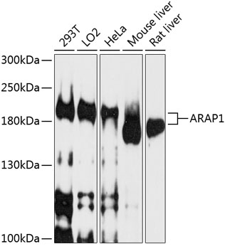 Western blot - ARAP1 Polyclonal Antibody 