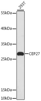 Western blot - CEP27 Polyclonal Antibody 