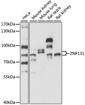 Western blot - ZNF131 Polyclonal Antibody 