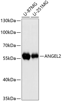 Western blot - ANGEL2 Polyclonal Antibody 