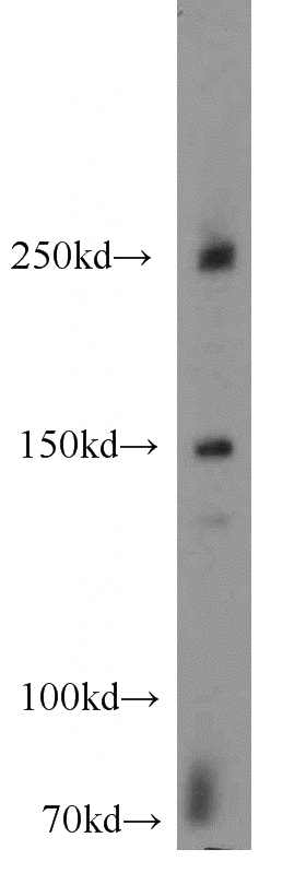 mouse brain tissue were subjected to SDS PAGE followed by western blot with Catalog No:113214(NPHP4 antibody) at dilution of 1:600