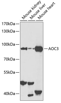Western blot - AOC3 Polyclonal Antibody 