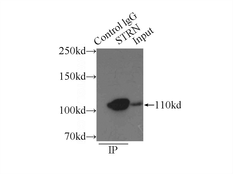 IP Result of anti-STRN (IP:Catalog No:115737, 4ug; Detection:Catalog No:115737 1:1000) with mouse brain tissue lysate 8000ug.
