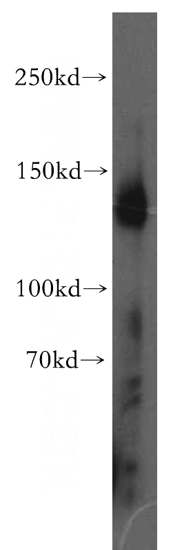 human placenta tissue were subjected to SDS PAGE followed by western blot with Catalog No:110329(NID1 antibody) at dilution of 1:200