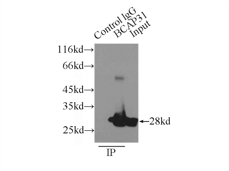 IP Result of anti-BCAP31 (IP:Catalog No:108421, 3ug; Detection:Catalog No:108421 1:1000) with A431 cells lysate 3300ug.