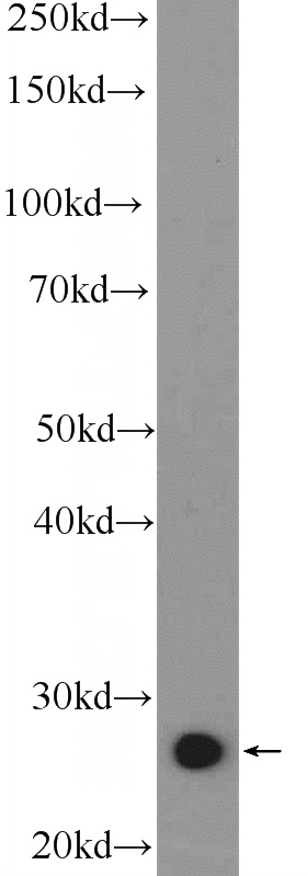 mouse liver tissue were subjected to SDS PAGE followed by western blot with Catalog No:112331(LRRC29 Antibody) at dilution of 1:300