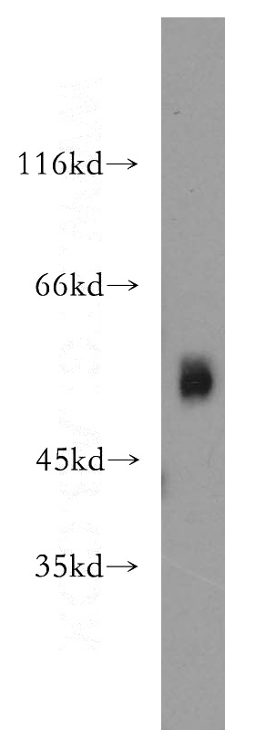 HeLa cells were subjected to SDS PAGE followed by western blot with Catalog No:115624(ST3GAL4 antibody) at dilution of 1:300