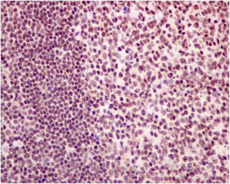 Immunohistochemistry assay of paraffin embedded tonsil tissue using anti-NRF1 ,showing nucleus staining.(x40)