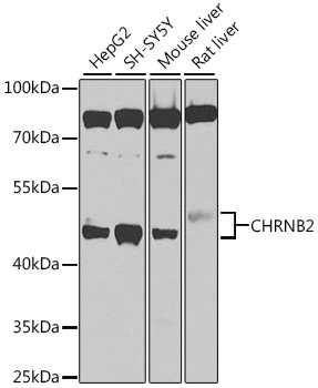 Western blot - CHRNB2 Polyclonal Antibody 