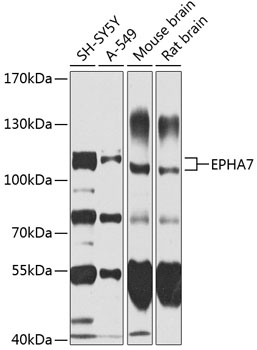 Western blot - EPHA7 Polyclonal Antibody 