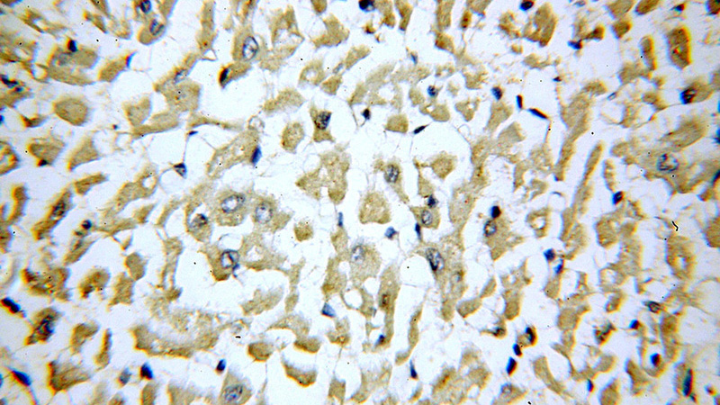 Immunohistochemical of paraffin-embedded human heart using Catalog No:115410(SLN antibody) at dilution of 1:100 (under 40x lens)