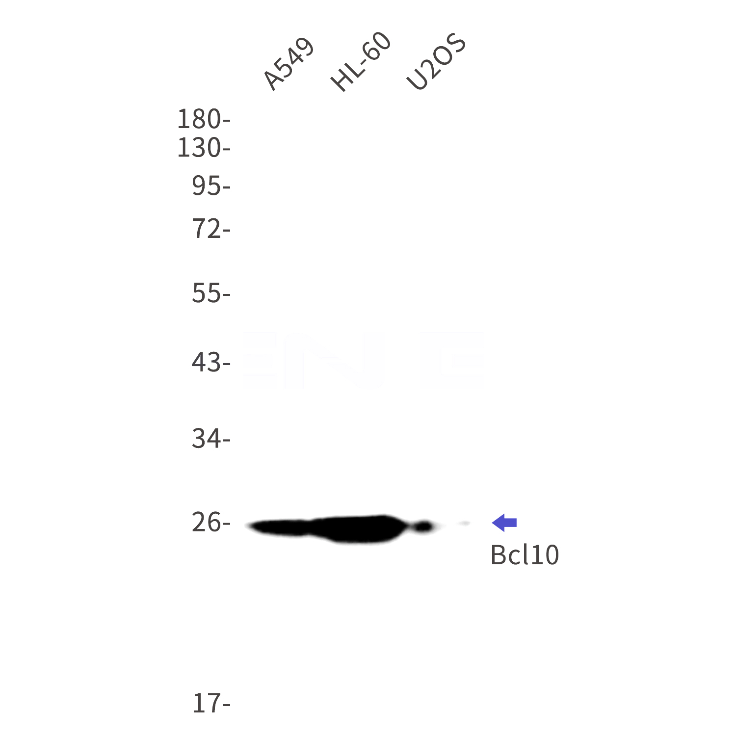 Western blot detection of Bcl10 in A549,HL-60,U2OS cell lysates using Bcl10 Rabbit mAb(1:1000 diluted).Predicted band size:26kDa.Observed band size:26kDa.
