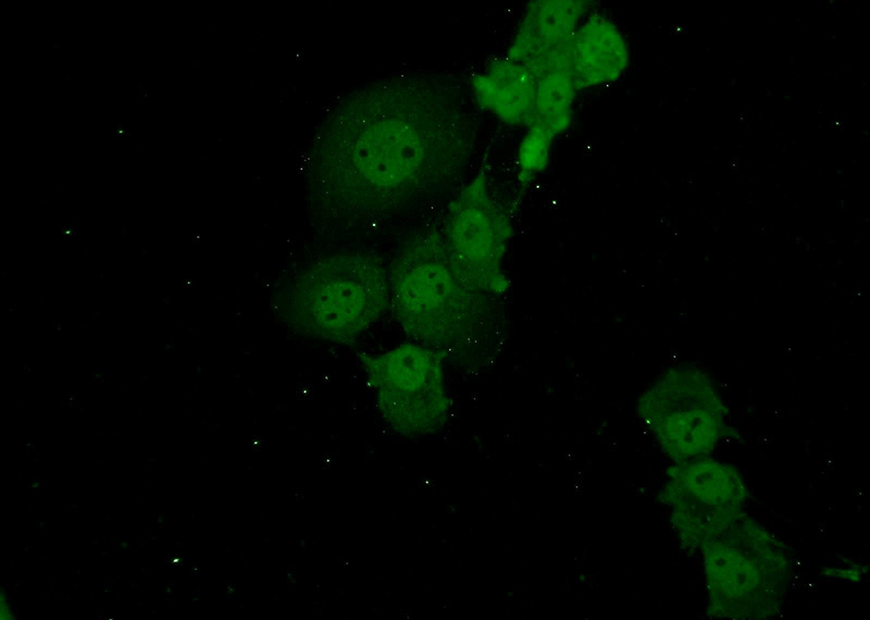 Immunofluorescent analysis of A431 cells using Catalog No:107777(ADAT2 Antibody) at dilution of 1:50 and Alexa Fluor 488-congugated AffiniPure Goat Anti-Rabbit IgG(H+L)