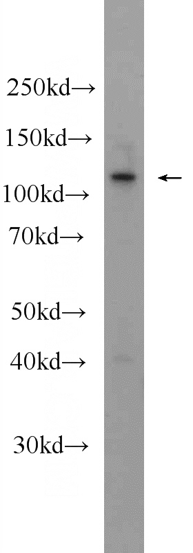 mouse colon tissue were subjected to SDS PAGE followed by western blot with Catalog No:111991(KIAA1217 Antibody) at dilution of 1:600