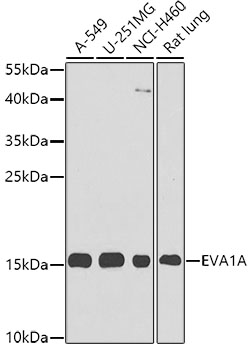 Western blot - EVA1A Polyclonal Antibody 
