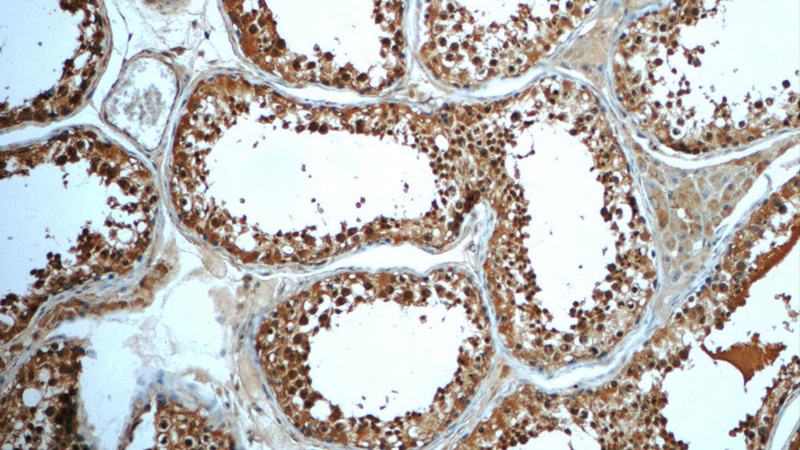 Immunohistochemistry of paraffin-embedded human testis tissue slide using Catalog No:111579(HYDIN Antibody) at dilution of 1:50 (under 10x lens)