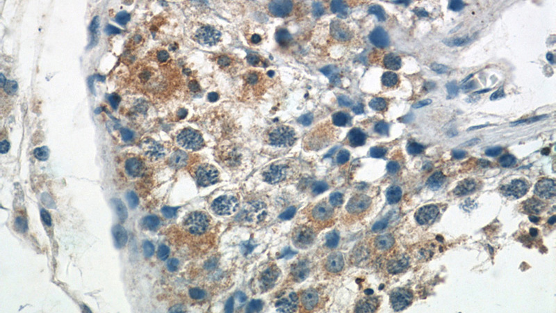 Immunohistochemistry of paraffin-embedded human testis tissue slide using Catalog No:116436(TSN Antibody) at dilution of 1:50 (under 40x lens)