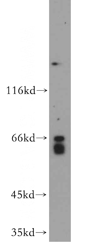 Jurkat cells were subjected to SDS PAGE followed by western blot with Catalog No:112973(MYLK2 antibody) at dilution of 1:500