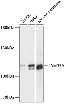 Western blot - FAM13A Polyclonal Antibody 