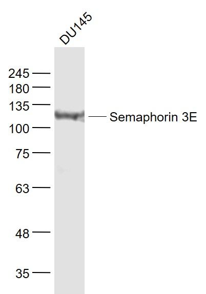 Fig1: Sample:; DU145(Human) Cell Lysate at 30 ug; Primary: Anti- Semaphorin 3E at 1/1000 dilution; Secondary: IRDye800CW Goat Anti-Rabbit IgG at 1/20000 dilution; Predicted band size: 86 kD; Observed band size: 111 kD
