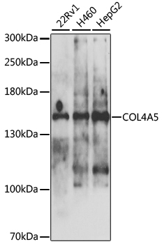 Western blot - COL4A5 Polyclonal Antibody 