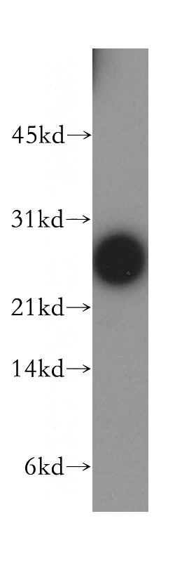 human brain tissue were subjected to SDS PAGE followed by western blot with Catalog No:109944(DIRAS1 antibody) at dilution of 1:1500