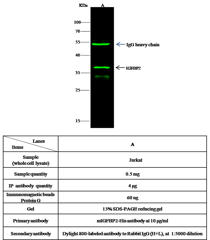 IGFBP-2 / IGFBP2 Antibody, Rabbit PAb, Antigen Affinity Purified, Immunoprecipitation