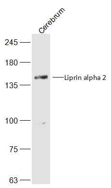 Fig1: Sample:; Cerebrum (Mouse) Lysate at 40 ug; Primary: Anti-Liprin alpha 2 at 1/300 dilution; Secondary: IRDye800CW Goat Anti-Rabbit IgG at 1/20000 dilution; Predicted band size: 143 kD; Observed band size: 143 kD