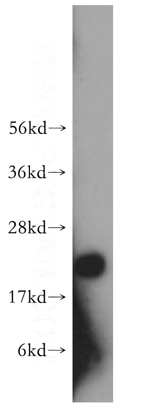 human heart tissue were subjected to SDS PAGE followed by western blot with Catalog No:116332(TAGLN2 antibody) at dilution of 1:600