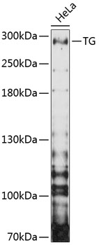 Western blot - TG Polyclonal Antibody 