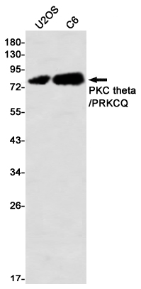Western blot detection of PKC theta/PRKCQ in U2OS,C6 using PKC theta/PRKCQ Rabbit mAb(1:1000 diluted)