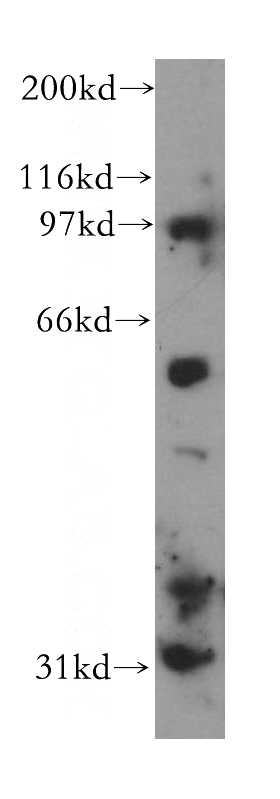 HepG2 cells were subjected to SDS PAGE followed by western blot with Catalog No:109300(CHST9 antibody) at dilution of 1:400