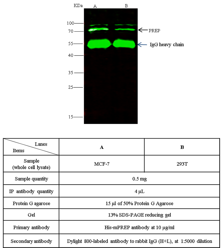 Prolyl endopeptidase / PREP Antibody, Rabbit PAb, Antigen Affinity Purified, Immunoprecipitation