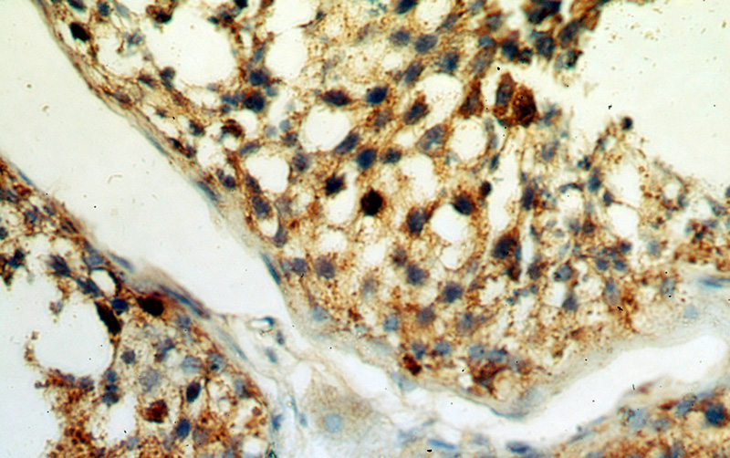 Immunohistochemical of paraffin-embedded human testis using Catalog No:108212(ASB17 antibody) at dilution of 1:50 (under 40x lens)