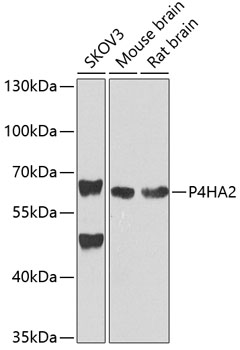 Western blot - P4HA2 Polyclonal Antibody 