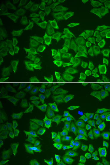 Immunofluorescence - CRHBP Polyclonal Antibody 
