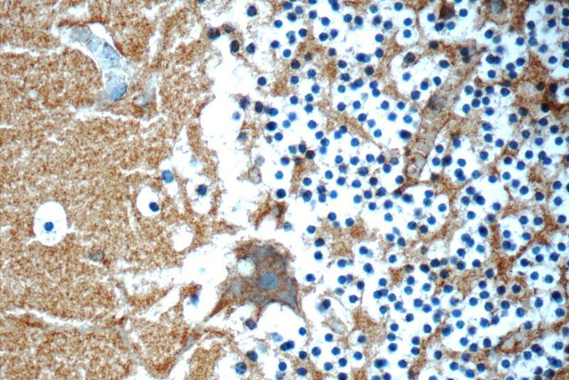 Immunohistochemistry of paraffin-embedded human cerebellum tissue slide using Catalog No:110939(GEMIN5 Antibody) at dilution of 1:50 (under 40x lens)