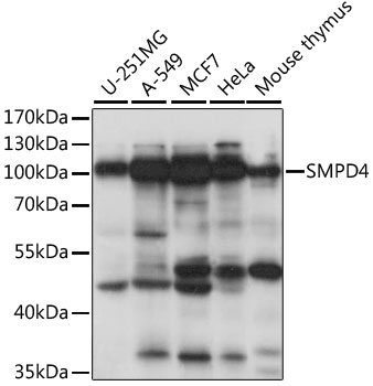 Western blot - SMPD4 Polyclonal Antibody 