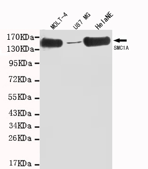 Western blot detection of SMC1A(C-term) in MOLT-4,U87 MG and HelaNE cell lysates using SMC1A (N-terminus) mouse mAb (1:1000 diluted).Predicted band size: 143KDa.Observed band size: 143KDa.
