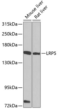 Western blot - LRP5 Polyclonal Antibody 