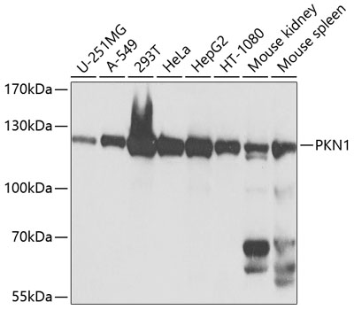 Western blot - PKN1 Polyclonal Antibody 