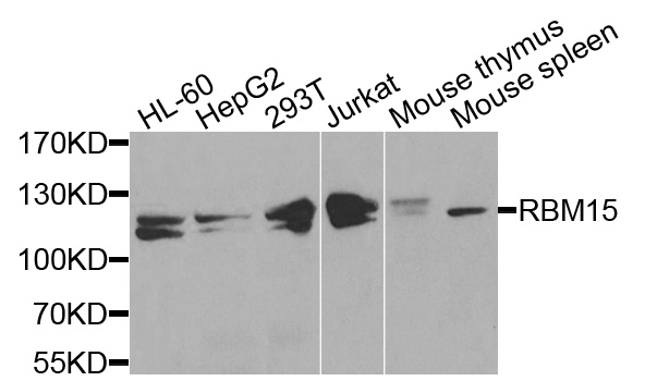 Western blot - RBM15 Polyclonal Antibody 