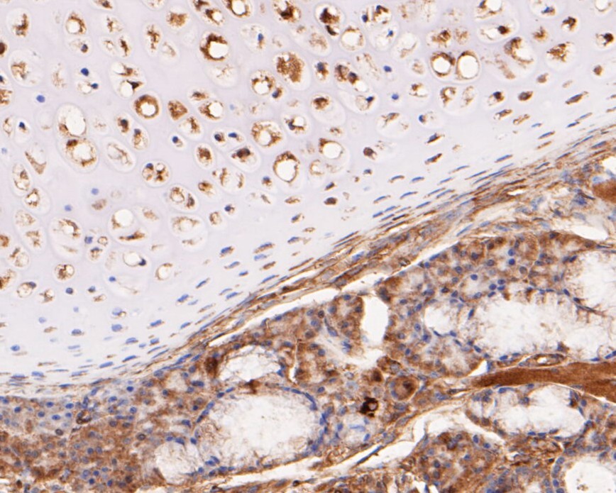 Fig2:; Immunohistochemical analysis of paraffin-embedded rat adrenaline tissue using anti-KCNK2 antibody. The section was pre-treated using heat mediated antigen retrieval with Tris-EDTA buffer (pH 8.0-8.4) for 20 minutes.The tissues were blocked in 5% BSA for 30 minutes at room temperature, washed with ddH; 2; O and PBS, and then probed with the primary antibody ( 1/100) for 30 minutes at room temperature. The detection was performed using an HRP conjugated compact polymer system. DAB was used as the chromogen. Tissues were counterstained with hematoxylin and mounted with DPX.