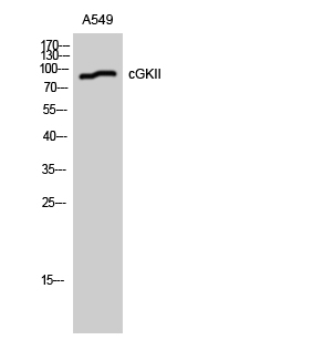 Fig1:; Western Blot analysis of A549 cells using cGKII Polyclonal Antibody diluted at 1: 1000