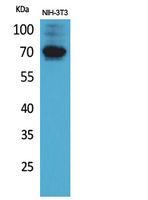 Fig1:; Western Blot analysis of NIH-3T3 cells using CD316 Polyclonal Antibody.. Secondary antibody（catalog#: HA1001) was diluted at 1:20000