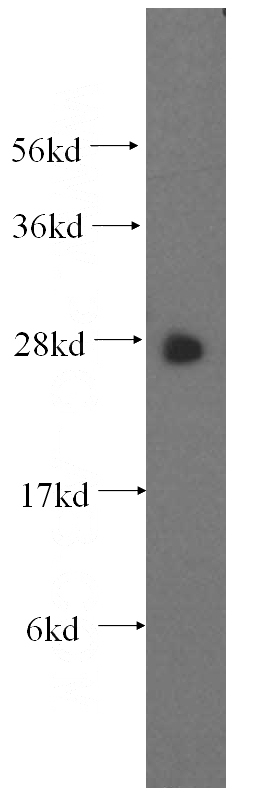 human brain tissue were subjected to SDS PAGE followed by western blot with Catalog No:111192(GSTT1 antibody) at dilution of 1:500