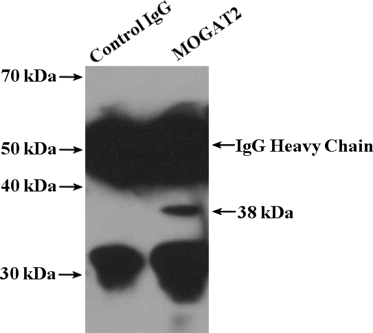 IP Result of anti-MOGAT2 (IP:Catalog No:112730, 4ug; Detection:Catalog No:112730 1:300) with HEK-293 cells lysate 4800ug.