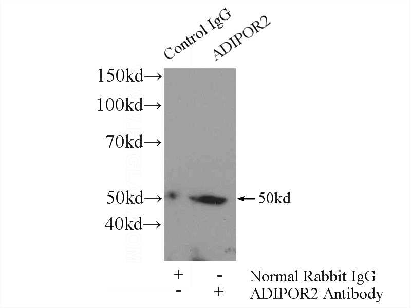 IP Result of anti-ADIPOR2 (IP:Catalog No:107794, 4ug; Detection:Catalog No:107794 1:500) with HeLa cells lysate 2800ug.