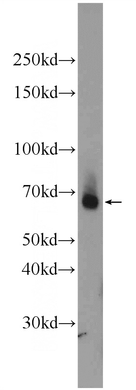 mouse small intestine tissue were subjected to SDS PAGE followed by western blot with Catalog No:108549(BTNL2 Antibody) at dilution of 1:600