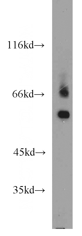 mouse testis tissue were subjected to SDS PAGE followed by western blot with Catalog No:116385(TTC39B antibody) at dilution of 1:800